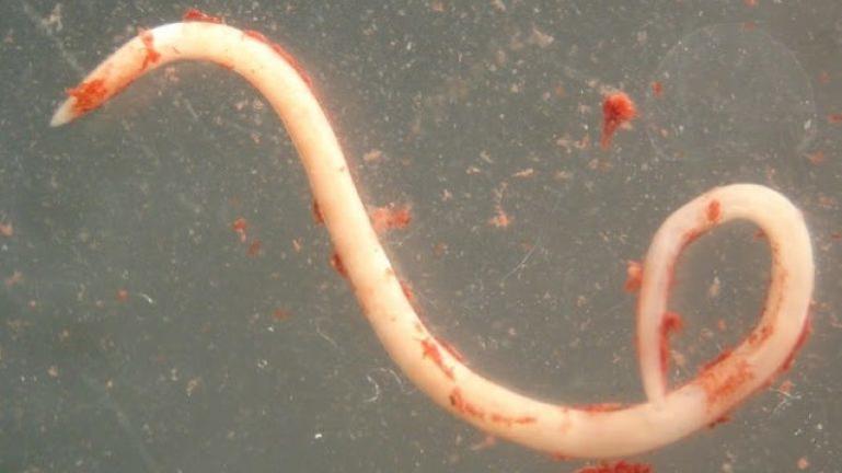 Παράσιτα στο σώμα: Τα συμπτώματα για να τα αναγνωρίσετε και ένα φυσικό αντιπαρασιτικό για να τα διώξετε