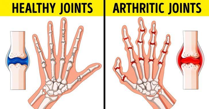 συμπτώματα-που-δείχνουν-ότι-έχεις-χαμηλό ανοσοποιητικό-