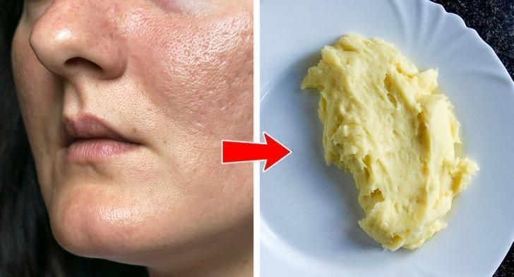 μυστικά ομορφιάς-από-την-Ανατολή-