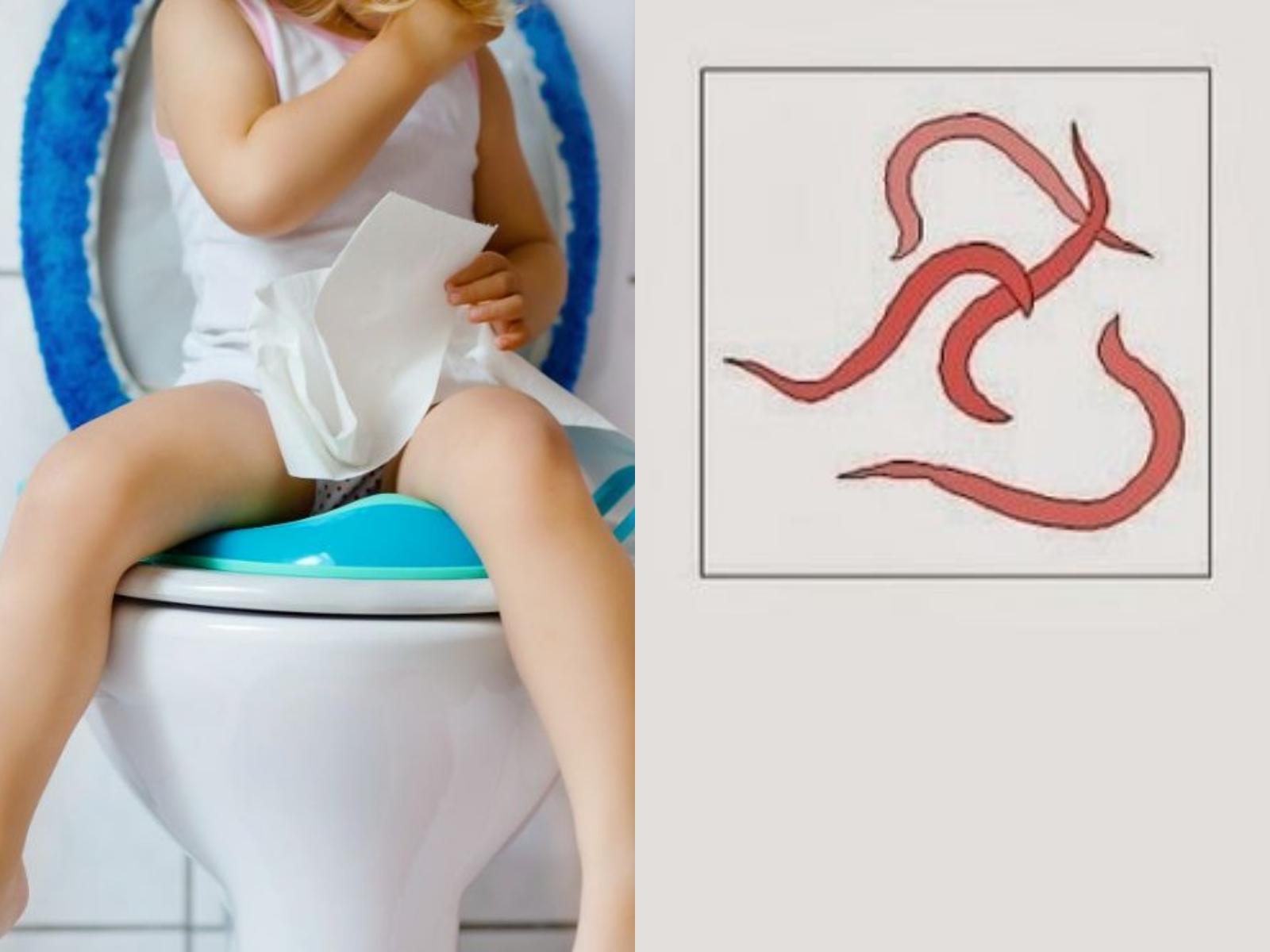 Σκουληκάκια-στα κακά-του-παιδιού-οξύουροι-