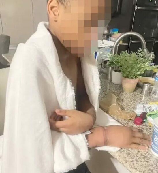 Φρίκη : Μάνα έδενε τα παιδιά και τους έριχνε χλωρίνη στα γεννητικά τους όργανα και στον λαιμό τους μέχρι να τους κάψει το δέρμα