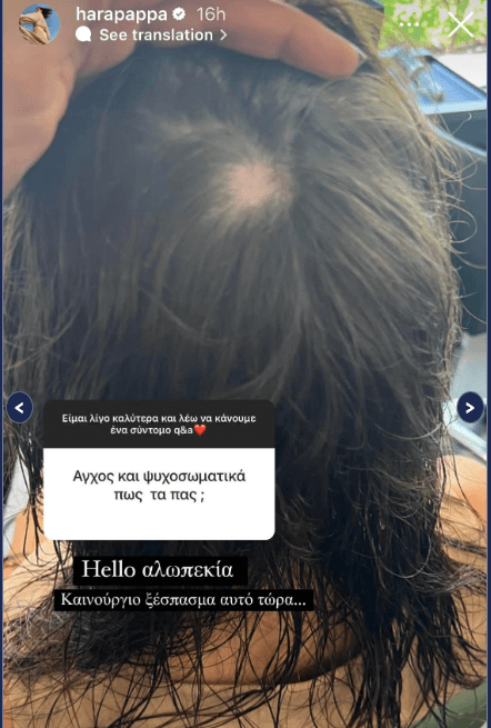 Χαρά Παππά: Ποιος είναι ο λόγος που χάνει τα μαλλιά της η πρώην παίκτρια του GNTM;