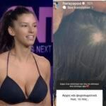 Χαρά Παππά: Ποιος είναι ο λόγος που χάνει τα μαλλιά της η πρώην παίκτρια του GNTM;