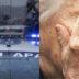 Φρίκη  : Ληστής ξυλοκόπησε άγρια ηλικιωμένη για να της κλέψει 5 ευρώ