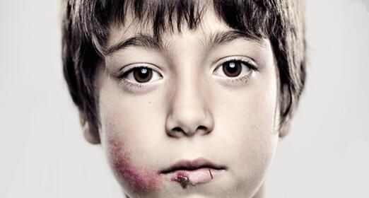 19 Νοεμβρίου Παγκόσμια ημέρα κατά της Κακοποίησης των Παιδιών