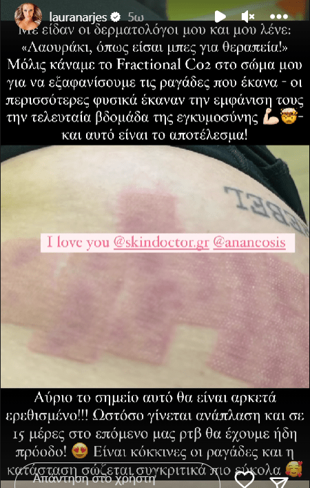 Λάουρα Νάργιες: Αυτή είναι η θεραπεία που κάνει για τα σημάδια εγκυμοσύνης