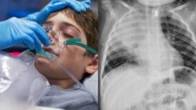 Σαρώνουν ιώσεις και πνευμονία στα παιδιά  : Τι συμβουλεύουν οι ειδικοί