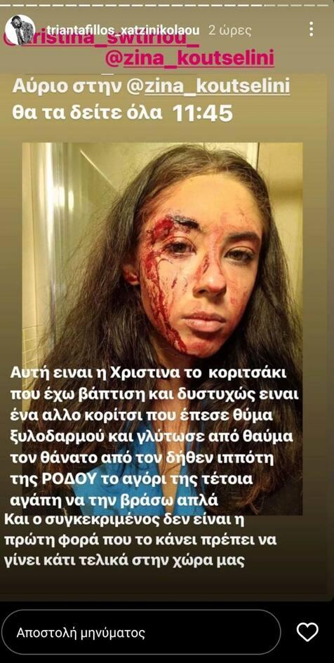 Τριαντάφυλλος : Το ξέσπασμα του για τον ξυλοδαρμό της βαφτιστήρας του