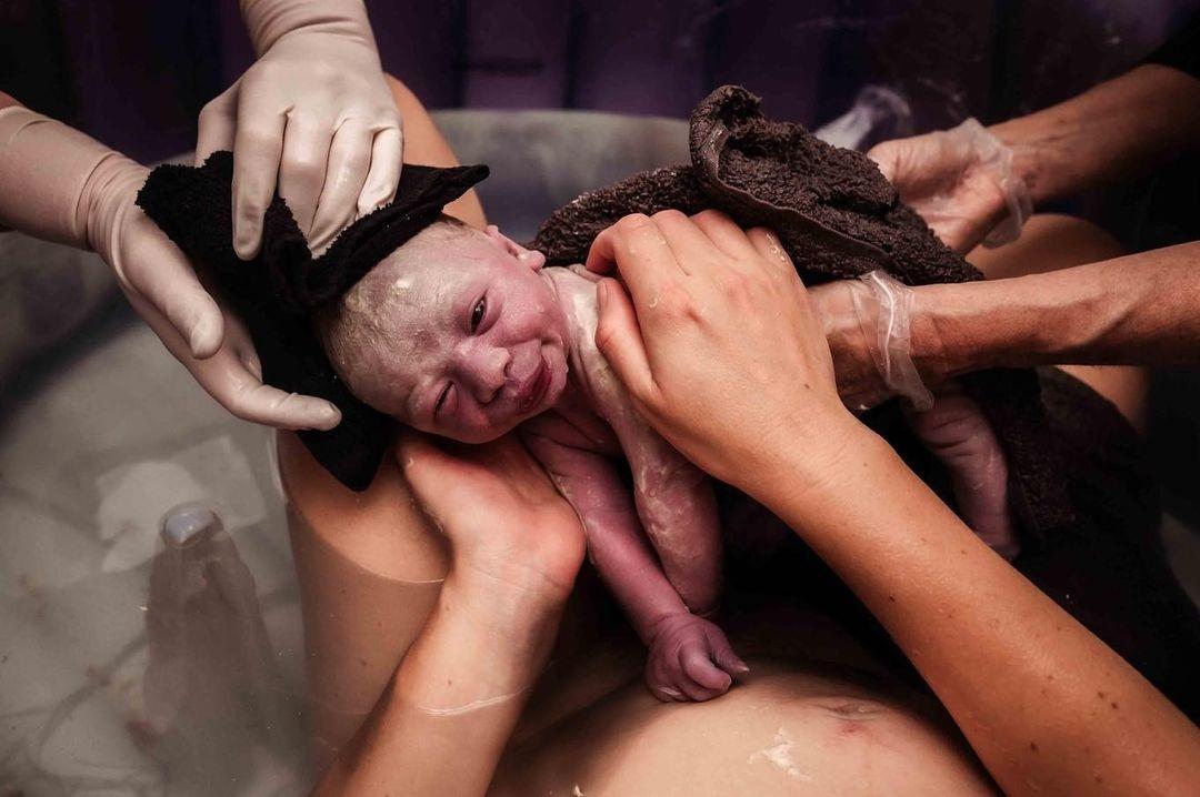 Η χρυσή ώρα: Γιατί τα μωρά πρέπει να αγκαλιαστούν αμέσως μόλις γεννηθούν