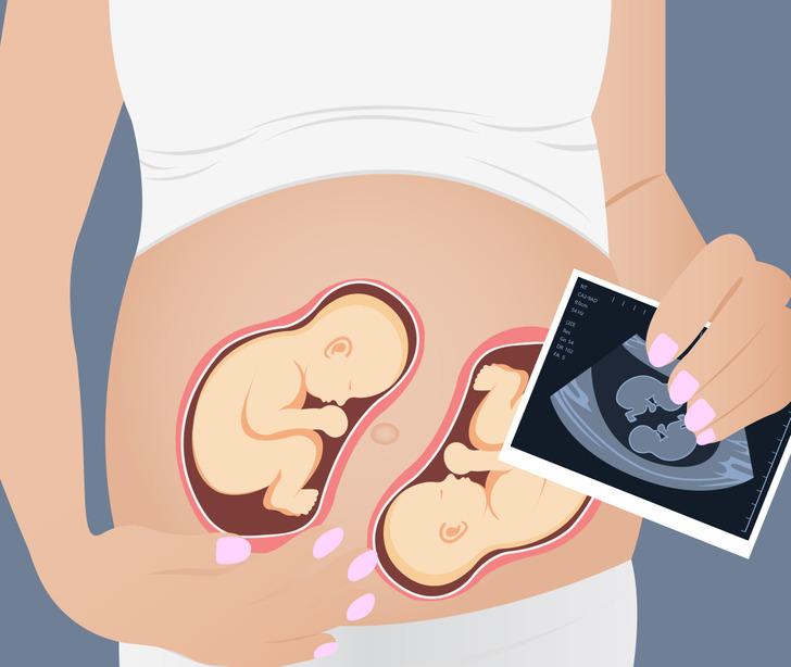 όταν-μία-έγκυος-μένει-και-πάλι-έγκυος-