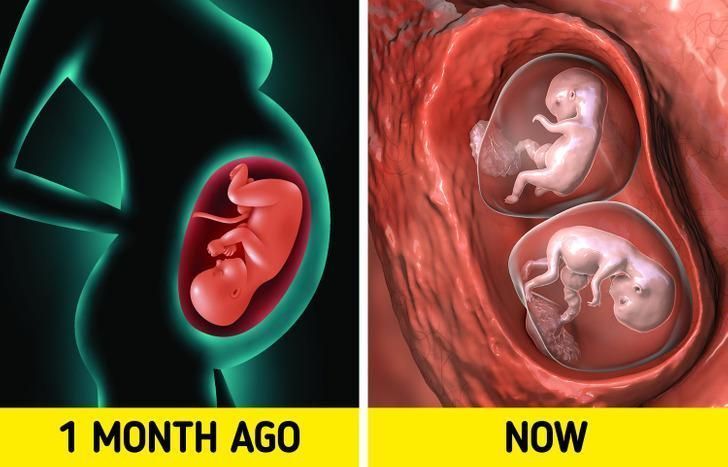 όταν-μία-έγκυος-μένει-και-πάλι-έγκυος-