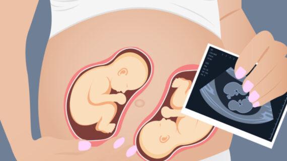 Μερικές γυναίκες μπορούν να μείνουν έγκυες όταν είναι ήδη έγκυες – Πώς γίνεται αυτό;