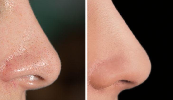 σπιτικές μάσκες-ομορφιάς-για-την-Πρωτοχρονιά-