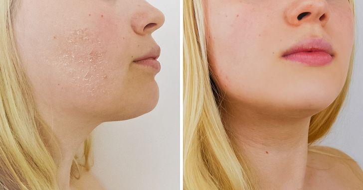 σπιτικές μάσκες-ομορφιάς-για-την-Πρωτοχρονιά-