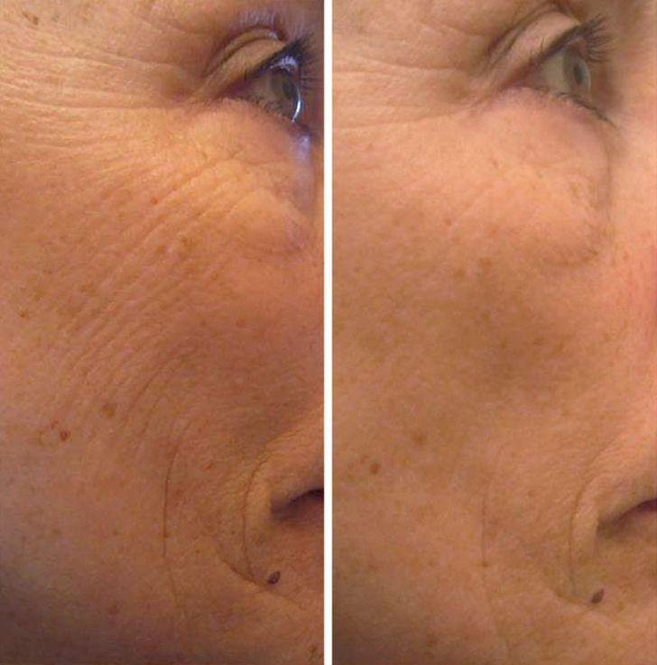 σπιτικές μάσκες-ομορφιάς-για-την-Πρωτοχρονιά-