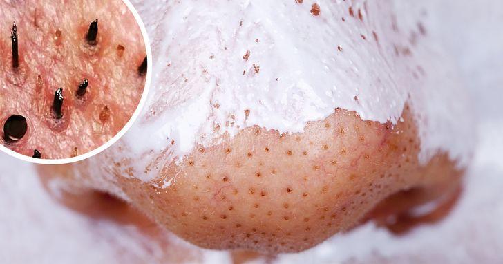 σπιτικές μάσκες-ομορφιάς-για-την-Πρωτοχρονιά-