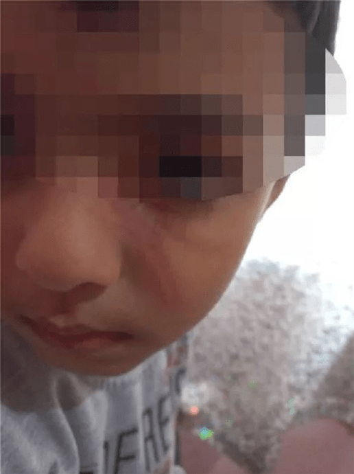 Φρίκη : Τέρατα γονείς έκλειναν με ταινία το στόμα των παιδιών τους και τα έκαιγαν με αναπτήρα