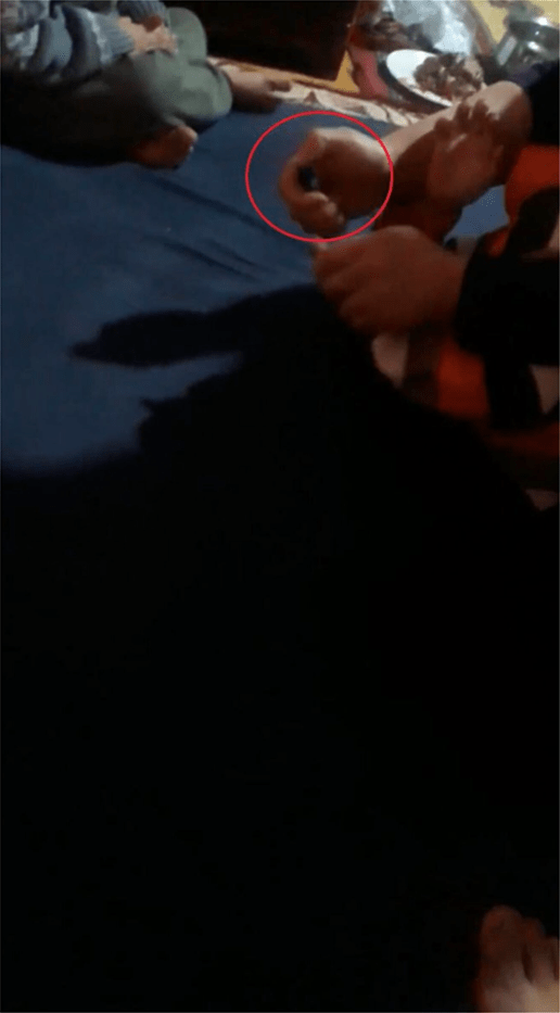 Φρίκη : Τέρατα γονείς έκλειναν με ταινία το στόμα των παιδιών τους και τα έκαιγαν με αναπτήρα