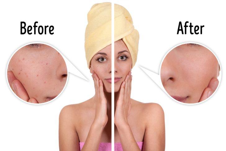 έξυπνα κόλπα-για-το-σπίτι-με-πατάτες-