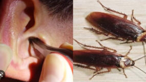 Λάρισα : Γυναίκα πήγε στο νοσοκομείο με κατσαρίδα στο αυτί της