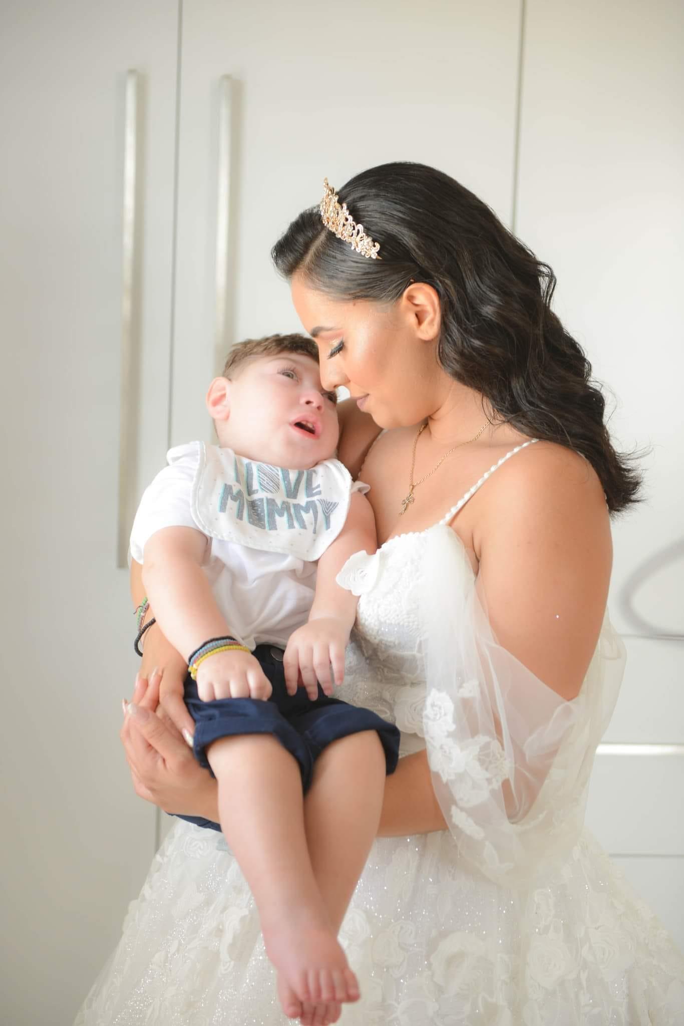 Νεκρός τρίχρονος από εγκεφαλοκήλη: Ο σπαραγμός των γονιών του