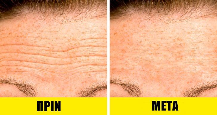 σπιτικές μάσκες-για-ρυτίδες-στο-μέτωπο- σπιτικές μάσκες-για-ρυτίδες-στο-μέτωπο-