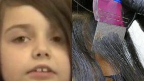 Τραγωδία : Νεκρή 12χρονη από ψείρες, της ήπιαν όλο το αίμα, συνελήφθησαν οι γονείς