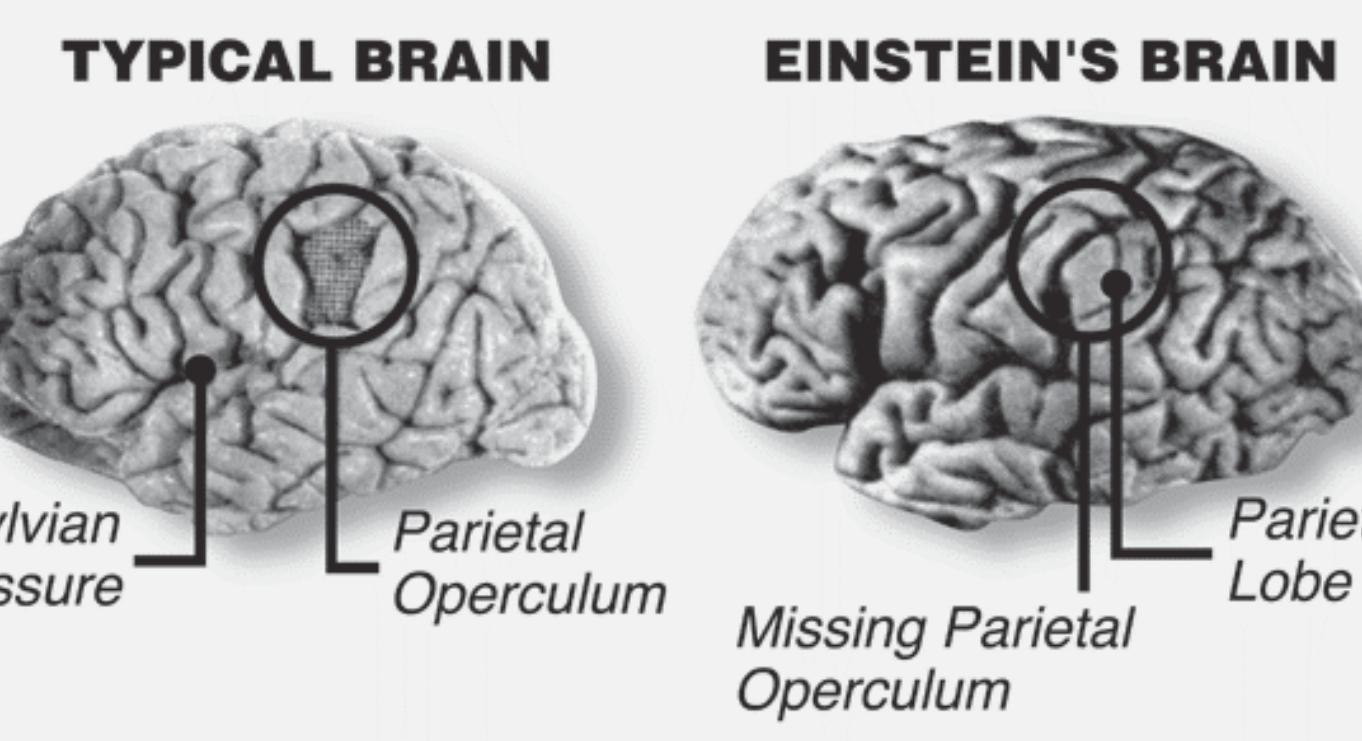 Άλμπερτ Αϊνστάιν: Ο γιατρός που διέπραξε την πιο μακάβρια κλοπή του αιώνα-Αυτή του εγκεφάλου του