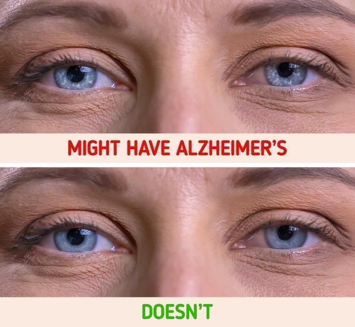 τα-μάτια-δείχνουν-πόσα-χρόνια-θα-ζήσεις-