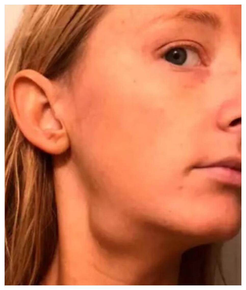 Απίστευτο: Aνακάλυψε ότι πάσχει από καρκίνο μέσα από Tik Τok