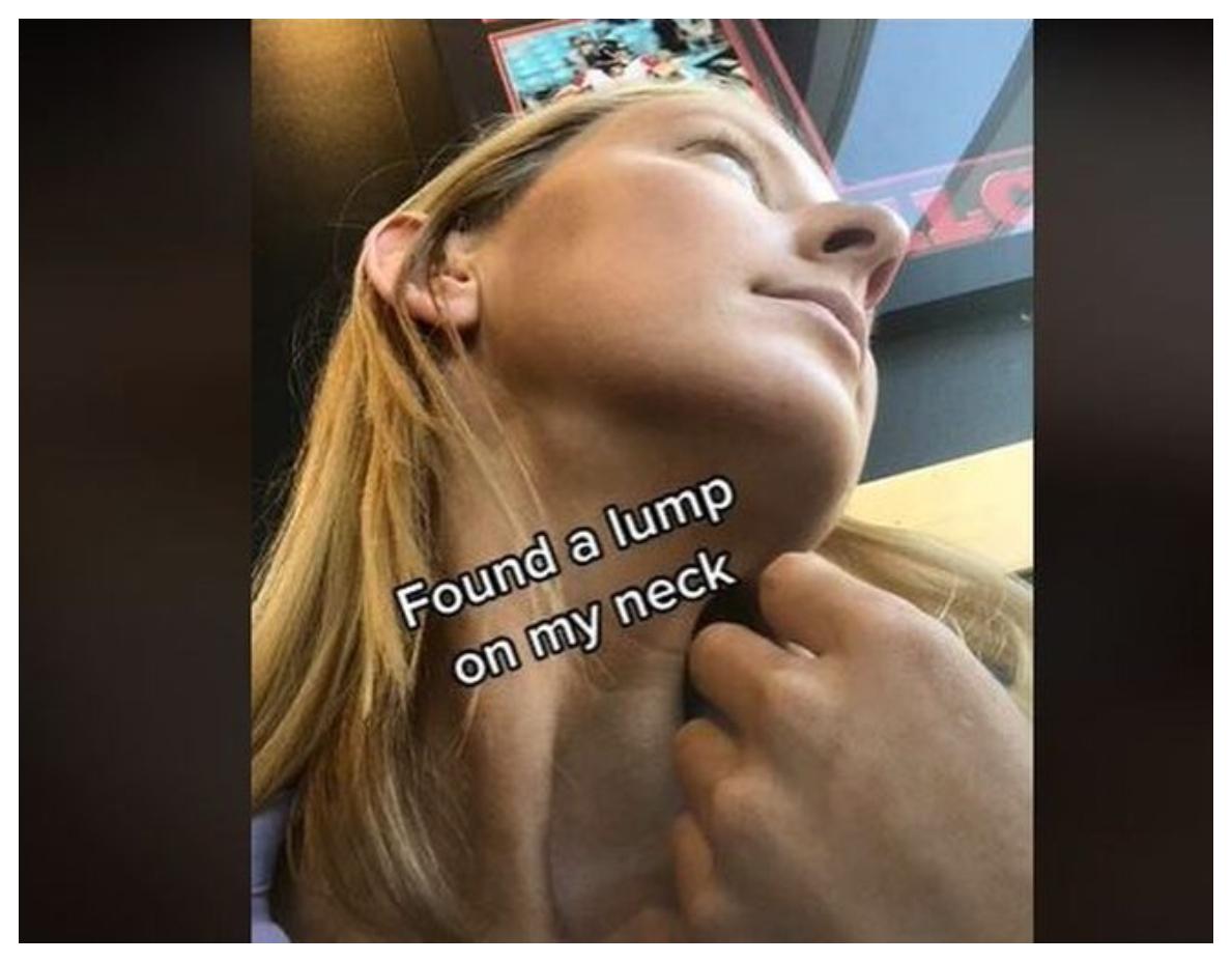 Απίστευτο: Aνακάλυψε ότι πάσχει από καρκίνο μέσα από Tik Τok