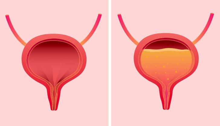 γιατί-δεν-πρέπει-να-κρατάτε-τα-ούρα-σας- γιατί-δεν-πρέπει-να-κρατάτε-τα-ούρα-σας-