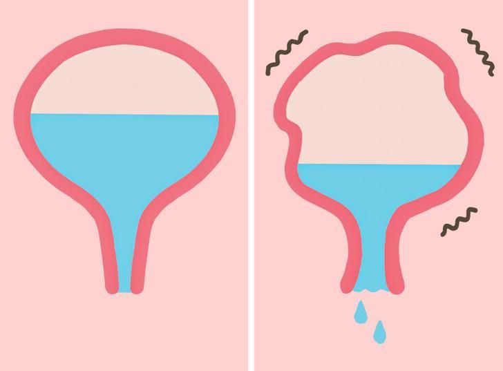 γιατί-δεν-πρέπει-να-κρατάτε-τα-ούρα-σας- γιατί-δεν-πρέπει-να-κρατάτε-τα-ούρα-σας-