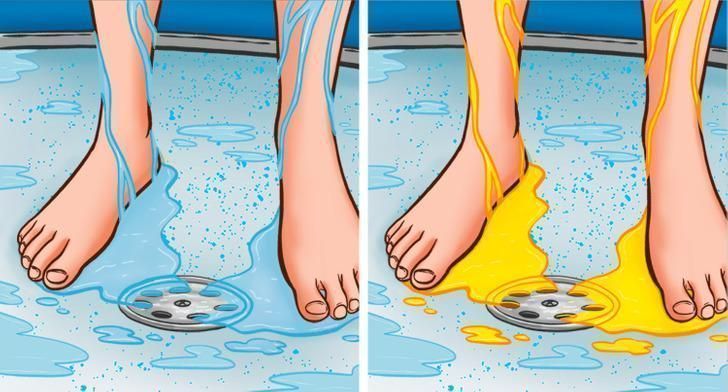 γιατί-δεν-πρέπει-να-κρατάτε-τα-ούρα-σας- γιατί-δεν-πρέπει-να-κρατάτε-τα-ούρα-σας-