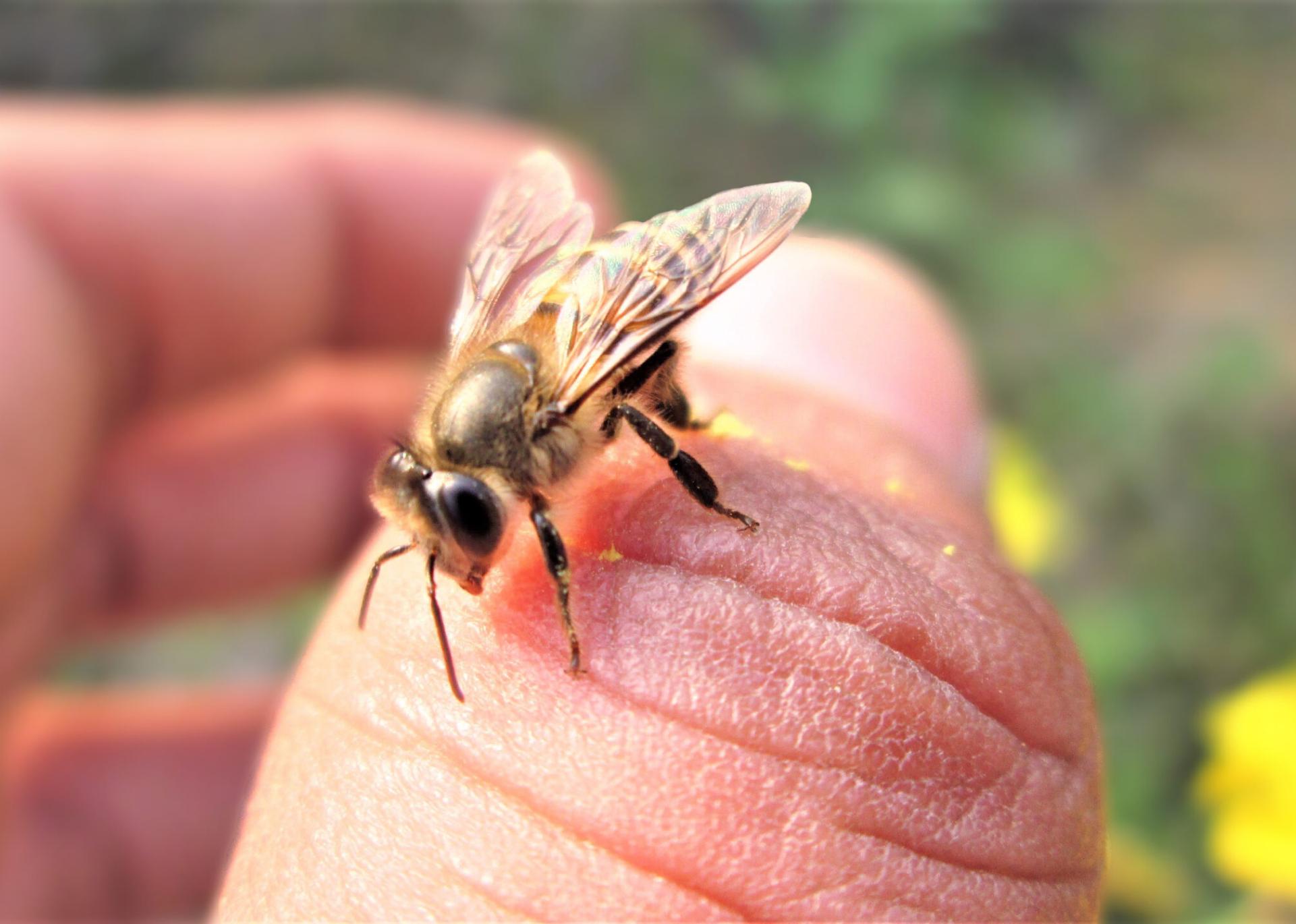 Τσίμπησε το παιδί μέλισσα ή σφήγκα; Τα συμπτώματα που δηλώνουν πως έπαθε αλλεργικό σοκ και πως να δράσετε