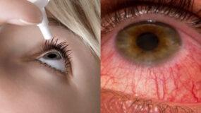 Ανοιξιάτικη αλλεργία στα μάτια: Συμπτώματα και τρόποι αντιμετώπισης