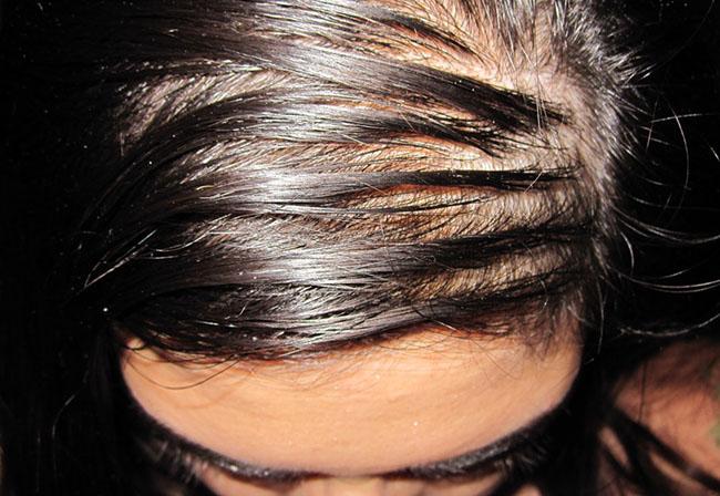 λαδωμένα μαλλιά-γιατί-λαδώνουν-εύκολα-και-πως-αντιμετωπίζουμε-το-πρόβλημα-