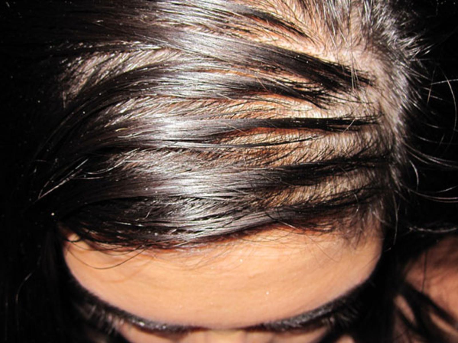 λαδωμένα μαλλιά-γιατί-λαδώνουν-εύκολα-και-πως-αντιμετωπίζουμε-το-πρόβλημα-