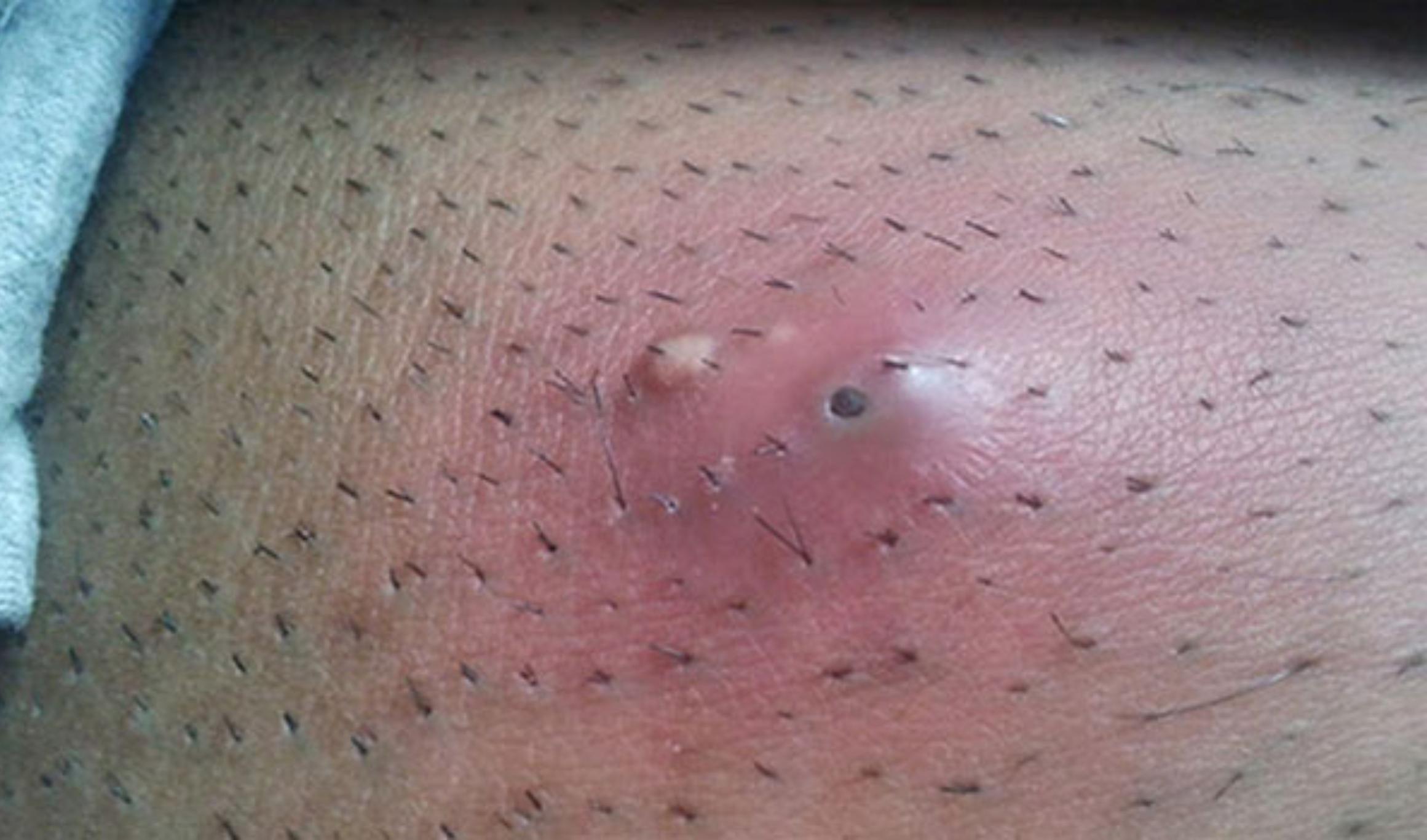 Τρίχες που γυρίζουν προς τα μέσα – Τι φταίει και πώς θα το αντιμετωπίσεις