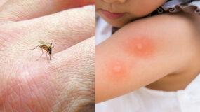 Χαμός από κουνούπια το φετινό καλοκαίρι: Πως θα προστατέψετε τα παιδιά από τα τσιμπήματα και θα τα αντιμετωπίσετε