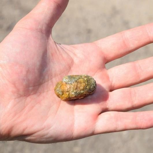 πόνος-στο-στομάχι-και-ασθένειες- πόνος-στο-στομάχι-και-ασθένειες-