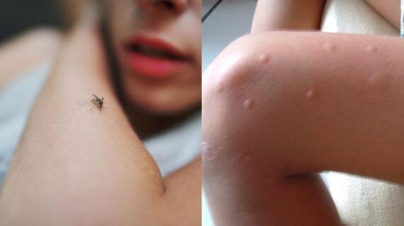 Ξέχνα ταμπλέτα και φιδάκι :Με αυτό το κόλπο διώχνεις μέχρι και 4.000 κουνούπια σε μία νύχτα