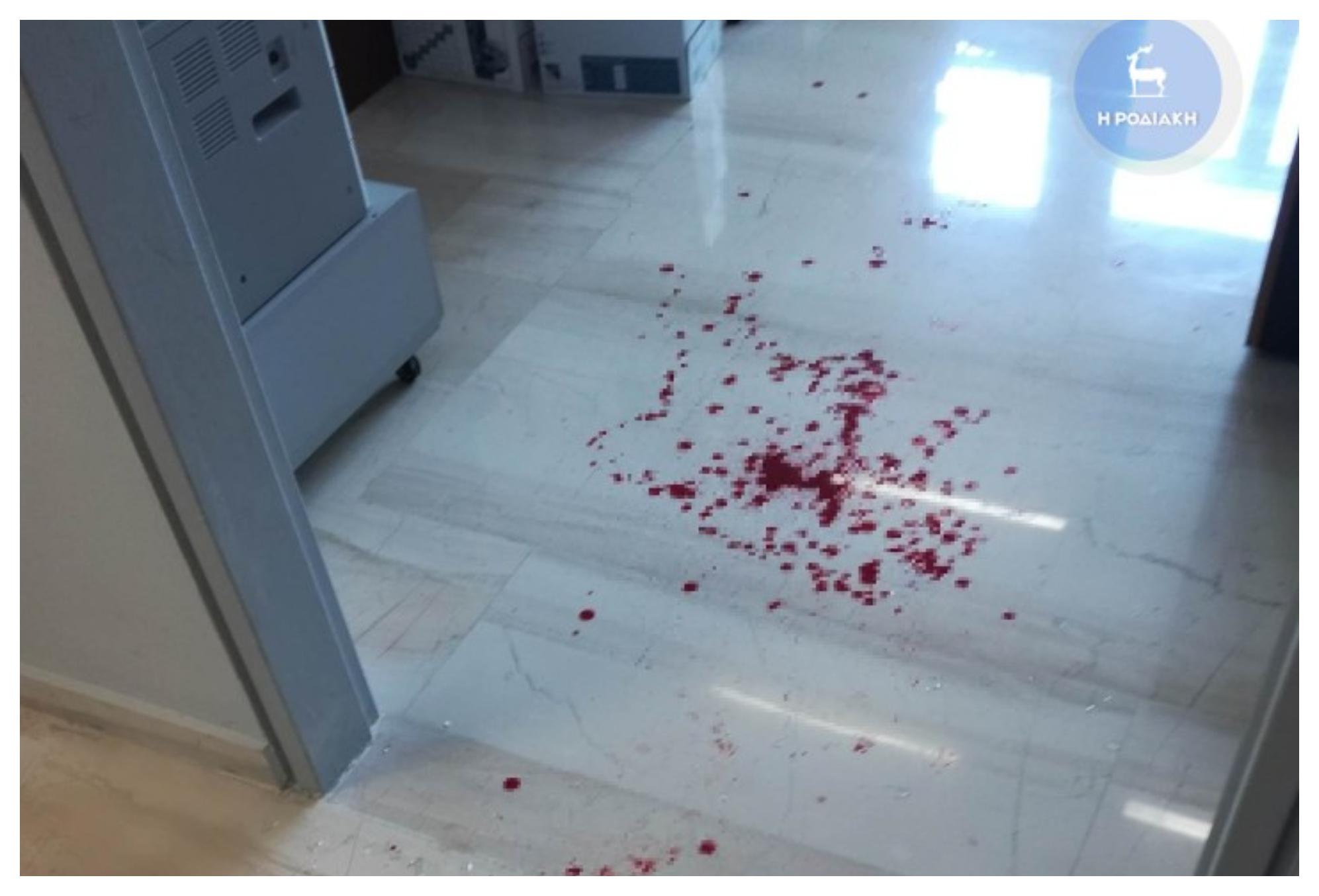 Άγριος καβγάς σε δημόσια υπηρεσία – Υπάλληλος χτύπησε πολίτη με κάδρο στο κεφάλι