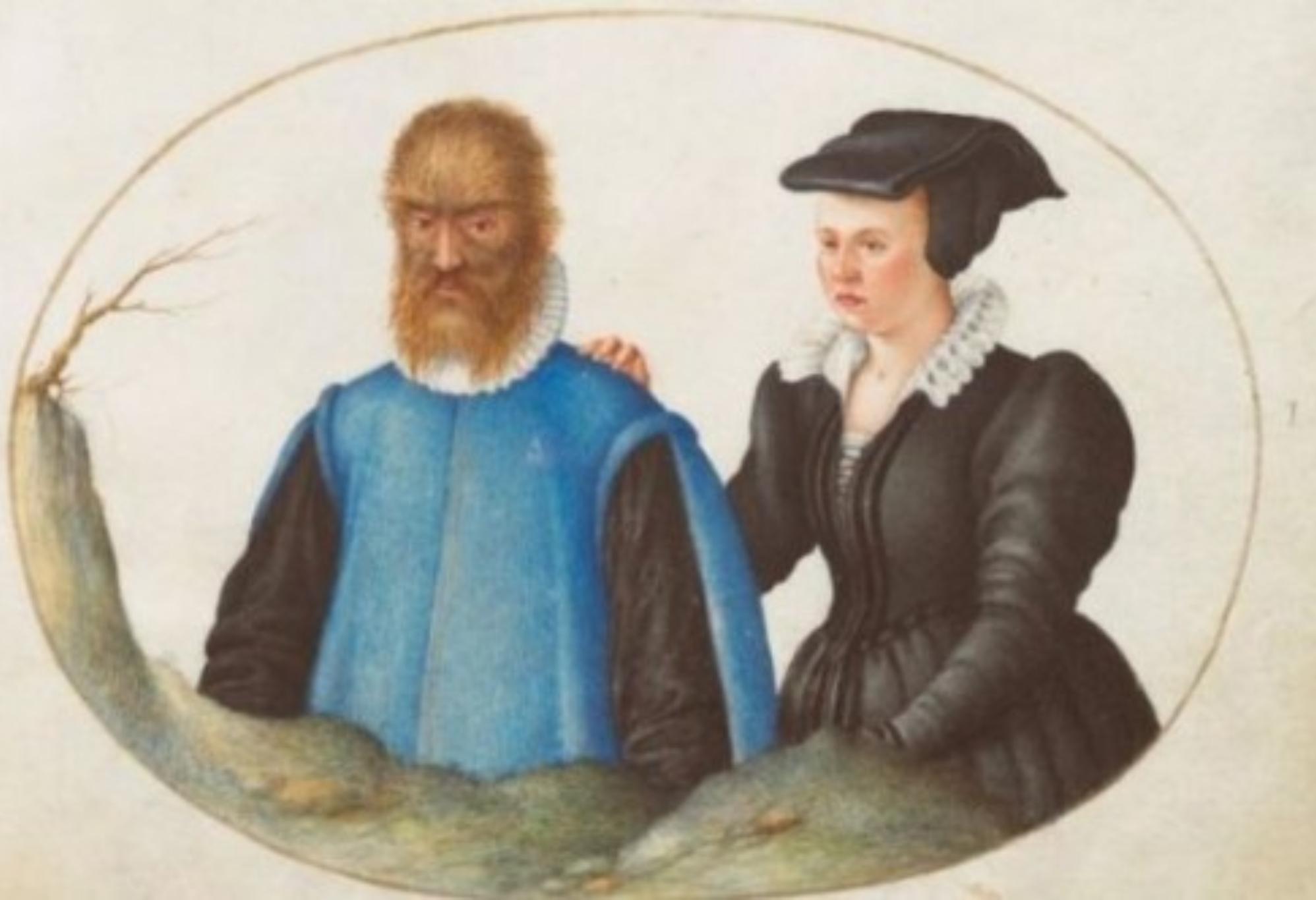 Η Πεντάμορφη και το Τέρας: Η αληθινή ιστορία αγάπης πίσω από το παραμύθι