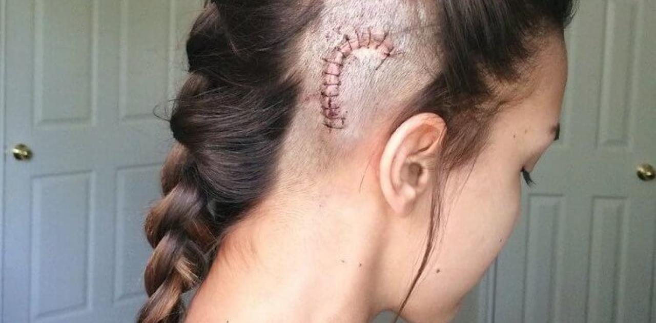 βαφή-για-μαλλιά-και-προβλήματα υγείας-