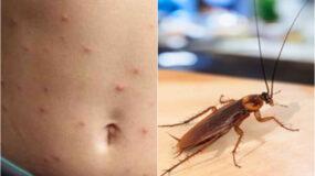 Κατσαρίδες: Τα προβλήματα υγείας που προκαλούν