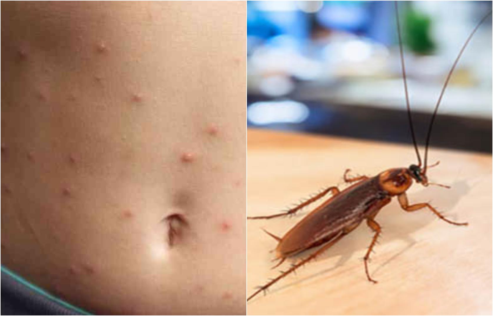 Κατσαρίδες: Τα προβλήματα υγείας που προκαλούν