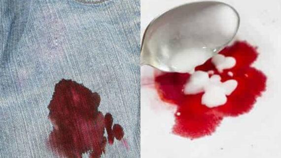 Λεκέδες από αίμα στα ρούχα στο στρώμα και στα έπιπλα: Πως να τους εξαφανίσετε