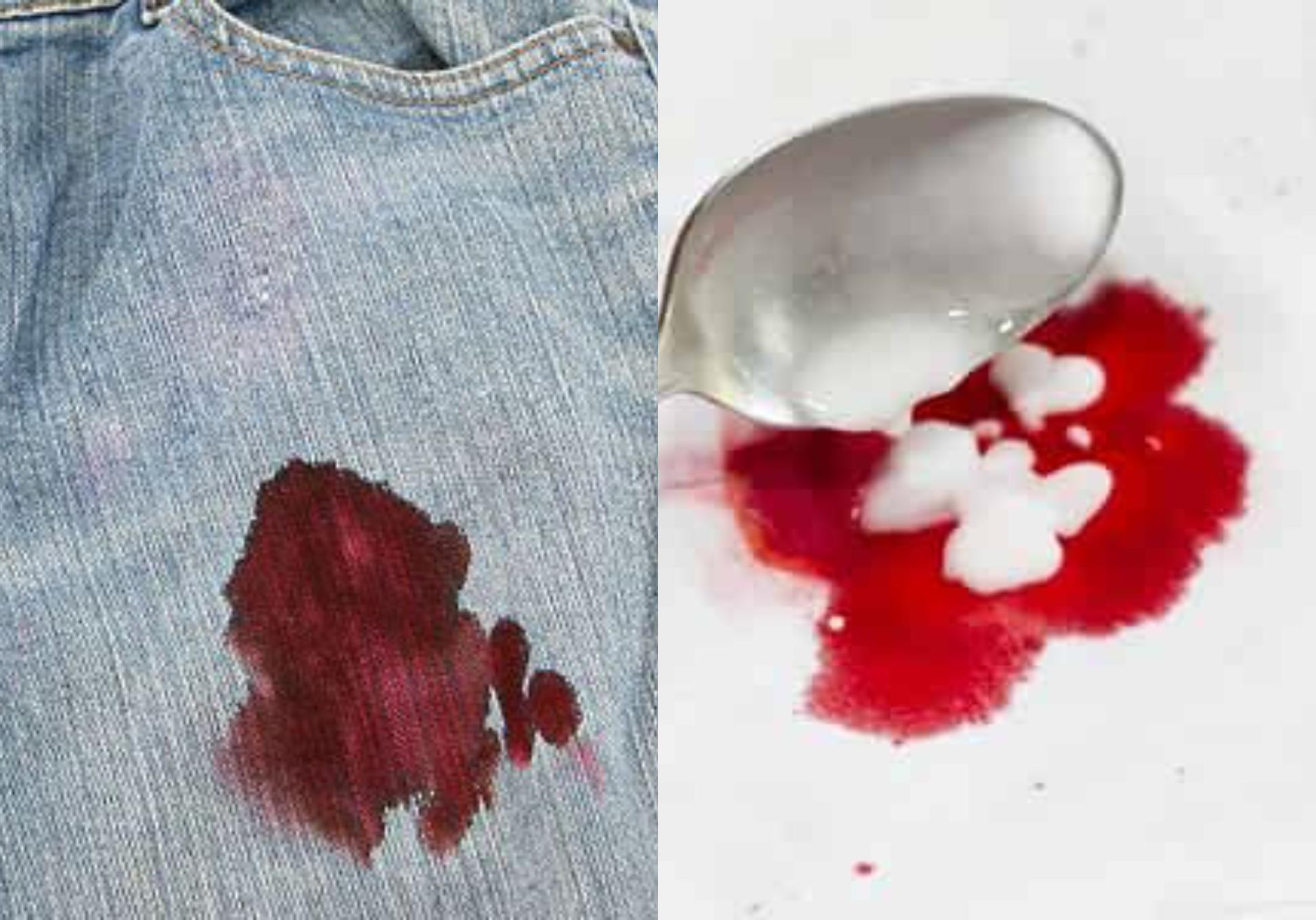 Λεκέδες από αίμα στα ρούχα στο στρώμα και στα έπιπλα: Πως να τους εξαφανίσετε