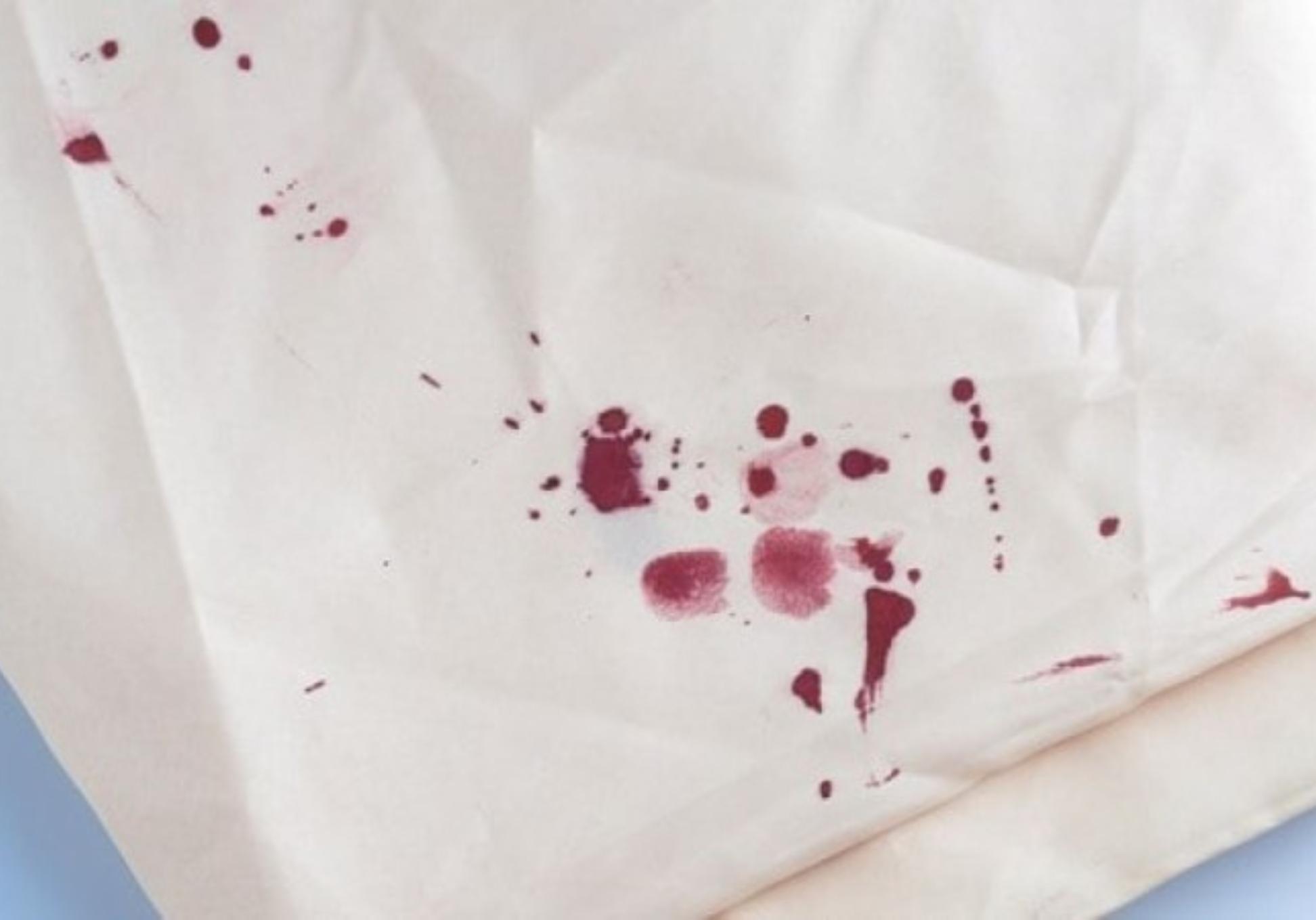 Λεκέδες από αίμα στα ρούχα στο στρώμα και στα έπιπλα: Πως να τους εξαφανίσετε